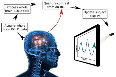 Santé Log : "Acouphènes | Le neurofeedback pour détourner l’attention du cortex auditif | Ce monde à inventer ! | Scoop.it
