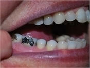 Teeth Tattoos | News | Dentagama | Daily Magazine | Scoop.it