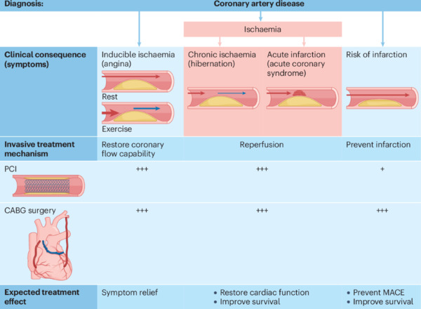 Invasive and medical management approaches to non-acute myocardial ischaemic syndromes | Interventional Cardiology | Scoop.it