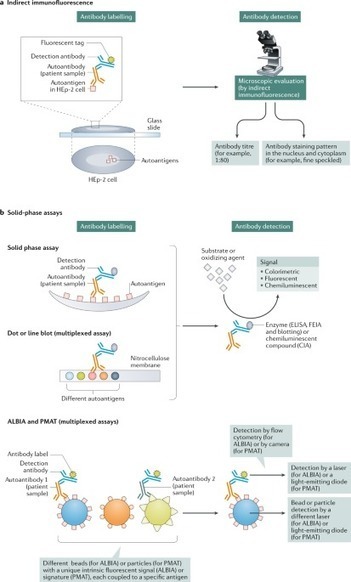 Understanding and interpreting antinuclear antibody tests in systemic rheumatic diseases | AUTOIMMUNITY | Scoop.it