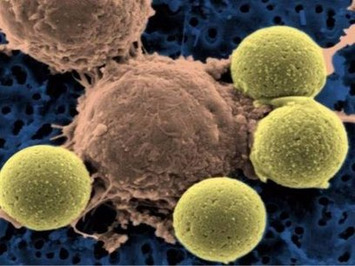 Why cancer treatments like the one Jimmy Carter used are suddenly gaining traction | The Health Report | Scoop.it
