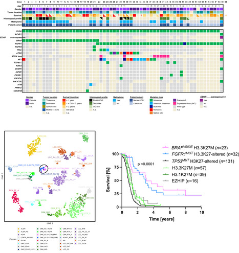 Identification d’un nouveau sous-type de gliomes diffus de la ligne médiane (DMG) présentant une interférence entre les mutations oncogéniques H3 K27 et BRAF/FGFR1 | Life Sciences Université Paris-Saclay | Scoop.it
