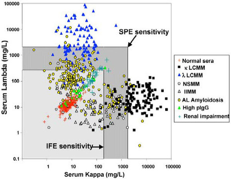Free light chains and their use in the diagnostic laboratory - WIKI | Immunology Diagnosis | Scoop.it
