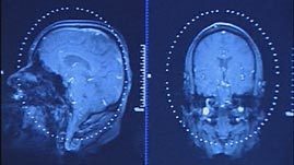 NOVA | Mirror Neurons | Educational Psychology, AI, & Emerging Technologies: Critical Thinking on Current Trends | Scoop.it
