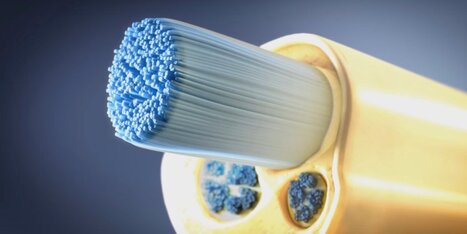 No More Pills? Tiny Nerve-Zapping Implants to Fight Disease | Chair et M&eacute;tal - L'Humanit&eacute; augment&eacute;e | Scoop.it