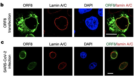 SARS-CoV-2 Disrupts Host Epigenetic Regulation Via Histone Mimicry | Virus World | Scoop.it