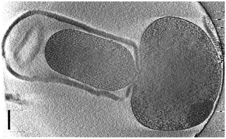 Percer le mystère de la dormance des pathogènes pour mieux les éliminer | Life Sciences Université Paris-Saclay | Scoop.it