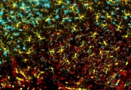 Pourquoi le cerveau a-t-il besoin des oméga 3 ? | ITERG - Nutrition, Santé et Biochimie des Lipides | Scoop.it