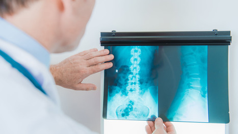 Spinal Arthritis Diagnostic Imaging Approach Part I&nbsp;| El Paso, TX Chiropractor | Call: 915-850-0900 | Spine Health & Spinal Hygiene | Scoop.it