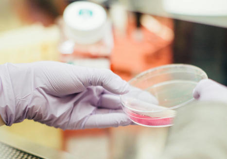 Estas células cerebrales pueden favorece la enfermedad de Alzheimer | Alzheimer y más (Boletín nº 70) | Scoop.it
