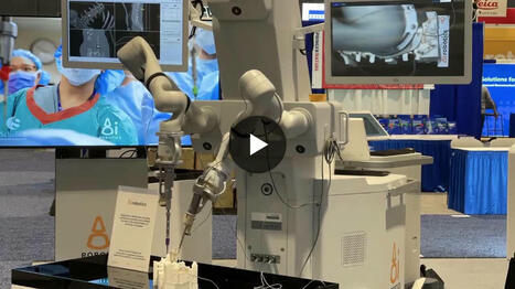 For those who haven't seen it yet, this is 8i Robotics Inc. | Lucien Blondel | ROBOTIC SURGERY | Scoop.it