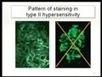 Immunology Part 1- hypersensitivity states... | Immunology for University Students | Scoop.it