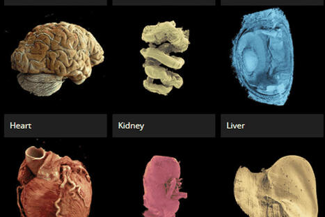 "On peut se balader &agrave; l'int&eacute;rieur de l'organe en 3D" : des scientifiques d&eacute;voilent le "Google Earth" du corps humain | CoreTech | Scoop.it