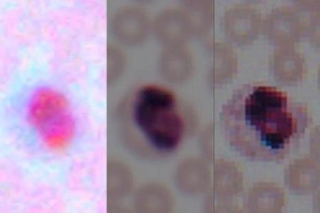 Deep learning transforms smartphone microscopes into laboratory-grade devices | Amazing Science | Scoop.it