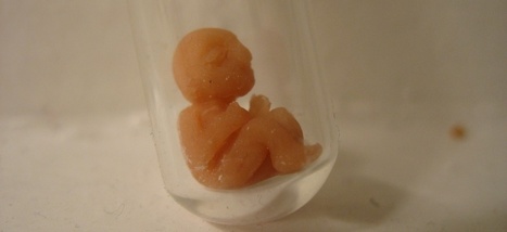 Les premiers pas de l&rsquo;ut&eacute;rus artificiel | Bio&eacute;thique & Procr&eacute;ation | Scoop.it