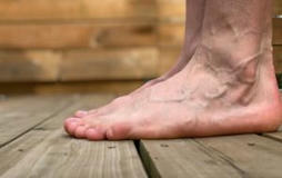 Understanding Bone Spurs on Top of Foot: Causes and Treatments | Foot Doctor houston | Scoop.it
