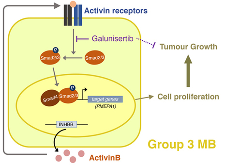 La voie TGF&beta;/Activine comme nouvelle cible th&eacute;rapeutique dans le m&eacute;dulloblastome de mauvais pronostic | Life Sciences Universit&eacute; Paris-Saclay | Scoop.it