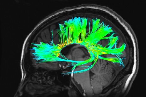 Can You Lie to an fMRI? | Science News | Scoop.it