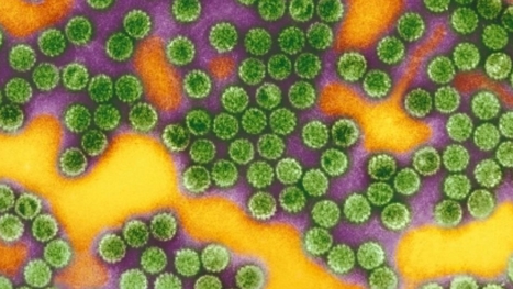 Le vaccin contre le papillomavirus se montre plus efficace que prévu | sida | Scoop.it