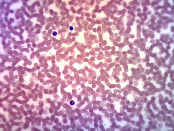 Research: New white blood cells after Tysabri - blog*spot | Immunology and Biotherapies | Scoop.it