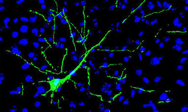 Implanted neurons become part of the brain | Luxembourg (Europe) | Scoop.it