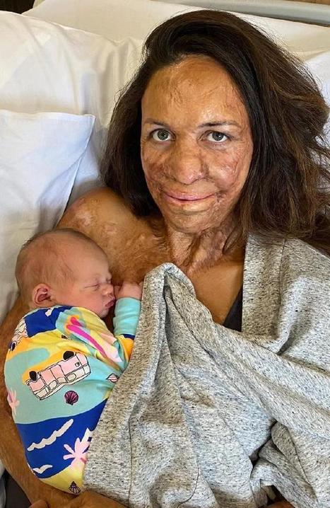 Turia Pitt gives birth to baby boy Rahiti with fiance Michael Hoskin | Name News | Scoop.it
