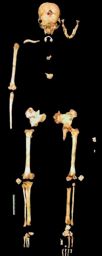 Was "the hobbit" a human with Down syndrome? Probably not | Aux origines | Scoop.it