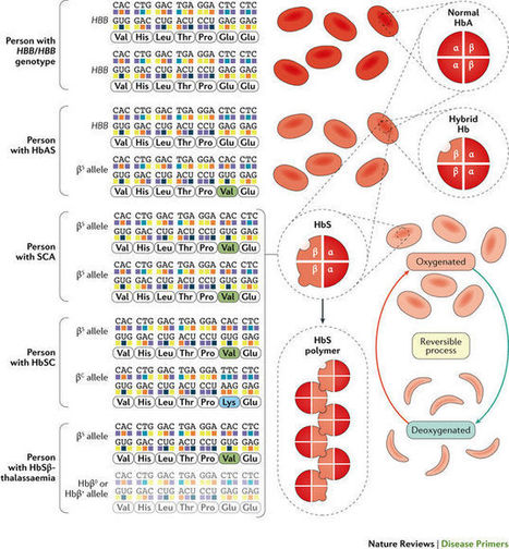 Sickle cell disease | Hematology | Scoop.it