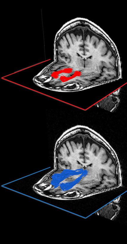 Breakdown of white-matter affects decisionmaking as we age | Amazing Science | Scoop.it