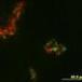 Implanted neurons, grown in the lab, take charge of brain circuitry | Science News | Scoop.it