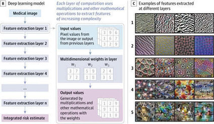 Machine Learning | IA - Intelligence artificielle en sant&eacute; | Scoop.it