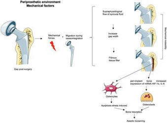 Frontiers | Roles of inflammatory cell infiltrate in periprosthetic osteolysis | Rheumatology-Rhumatologie | Scoop.it