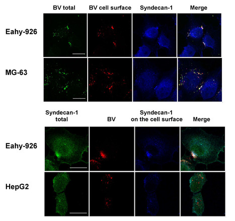 Un récepteur cellulaire humain reconnaissant un baculovirus identifié pour la première fois | Insect Archive | Scoop.it