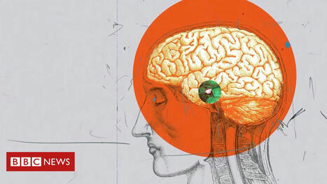 Como funciona o cérebro de um psicopata? | Inovação Educacional | Scoop.it