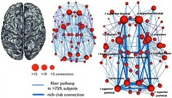 Hubs en el cableado neuronal del cerebro | Rafael Barzanallana | Scoop.it