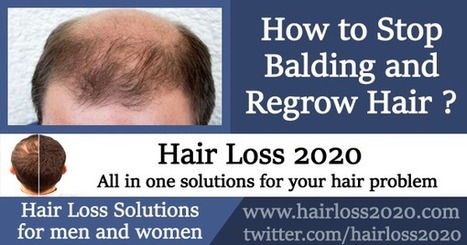 How To Stop Balding And Regrow Hair Scalp Exe