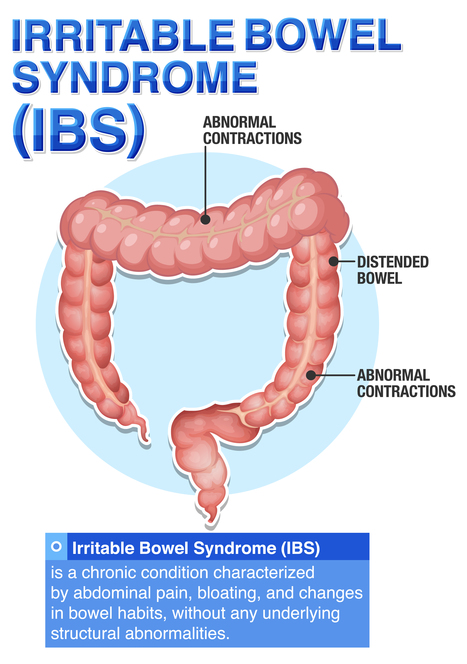Find lindring af IBS-symptomer med Kirurgen.DK's minimalt invasive procedurer | Patrick Holst | Scoop.it