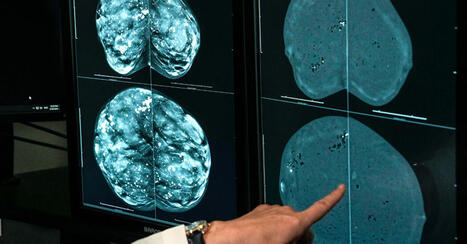 One Type of Mammogram Proves Better for Women With Dense Breasts. | Hospitals and Healthcare | Scoop.it