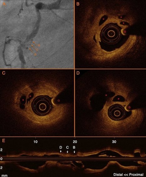 Adipocitocinas como nuevos marcadores de la enfermedad cardiovascular. Perspectivas fisiopatológicas y clínicas | Revista Española de Cardiología | PIENSA en VERDE | Scoop.it