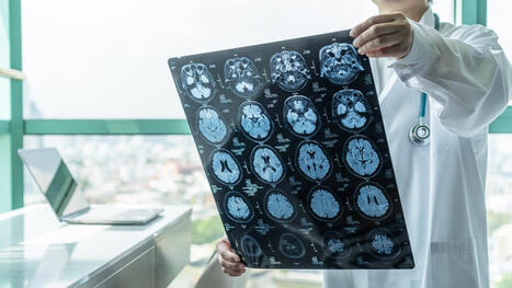 CEAFA advierte de esperas de 572 d&iacute;as para el diagn&oacute;stico de Alzheimer e inequidades territoriales en la atenci&oacute;n | Alzheimer y m&aacute;s (Bolet&iacute;n n&ordm; 90) | Scoop.it