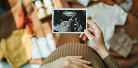 New Zealand&rsquo;s BMI threshold for publicly funded fertility treatment is outdated and unethical. Here&rsquo;s why it should go | Anthropometry and Kinanthropometry | Scoop.it
