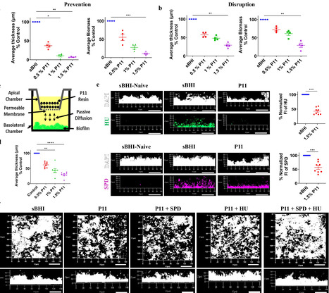 Spermidine is a common component of the eDNA-dependent biofilm matrix | npj | RMH | Scoop.it