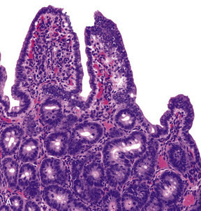 Bovine Coronavirus - an overview | ScienceDirect Topics | Mucosal Immunity | Scoop.it