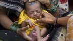 In pictures: Desperate battle to save India's children | News You Can Use - NO PINKSLIME | Scoop.it