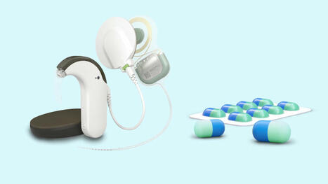 MED-EL et Sound Pharma collaborent pour préserver l’audition résiduelle | Revue de presse Implant Cochléaire | Scoop.it