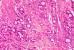 Are cancers newly evolved species? | No Such Thing As The News | Scoop.it