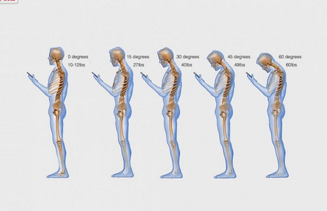 ‘Text neck’ is becoming an ‘epidemic’ and could wreck your spine | Amazing Science | Scoop.it