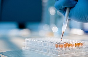 Peritoneal dialysis researchers get funding for first project | Peritoneal dialysis | Scoop.it