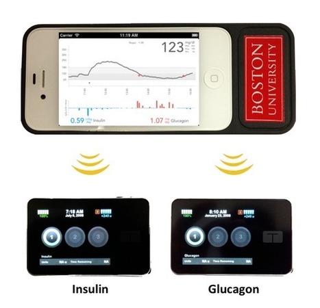 Un pancr&eacute;as bionique pour un contr&ocirc;le automatique et continu du diab&egrave;te | innovation & e-health | Scoop.it