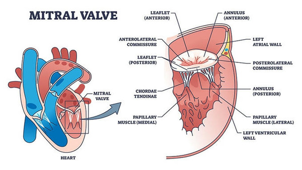 Large Trials Support Mitral Valve Repair in Heart Failure | Transcatheter Treatment of Mitral Regurgitation | Scoop.it